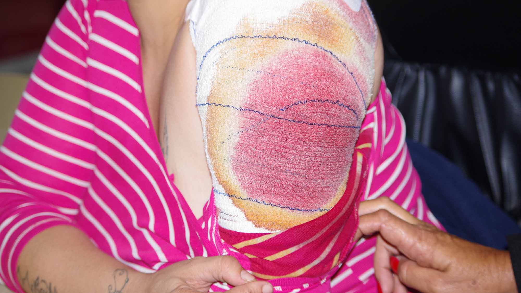 Woman shot during unrest sues UEDF for E3.5m